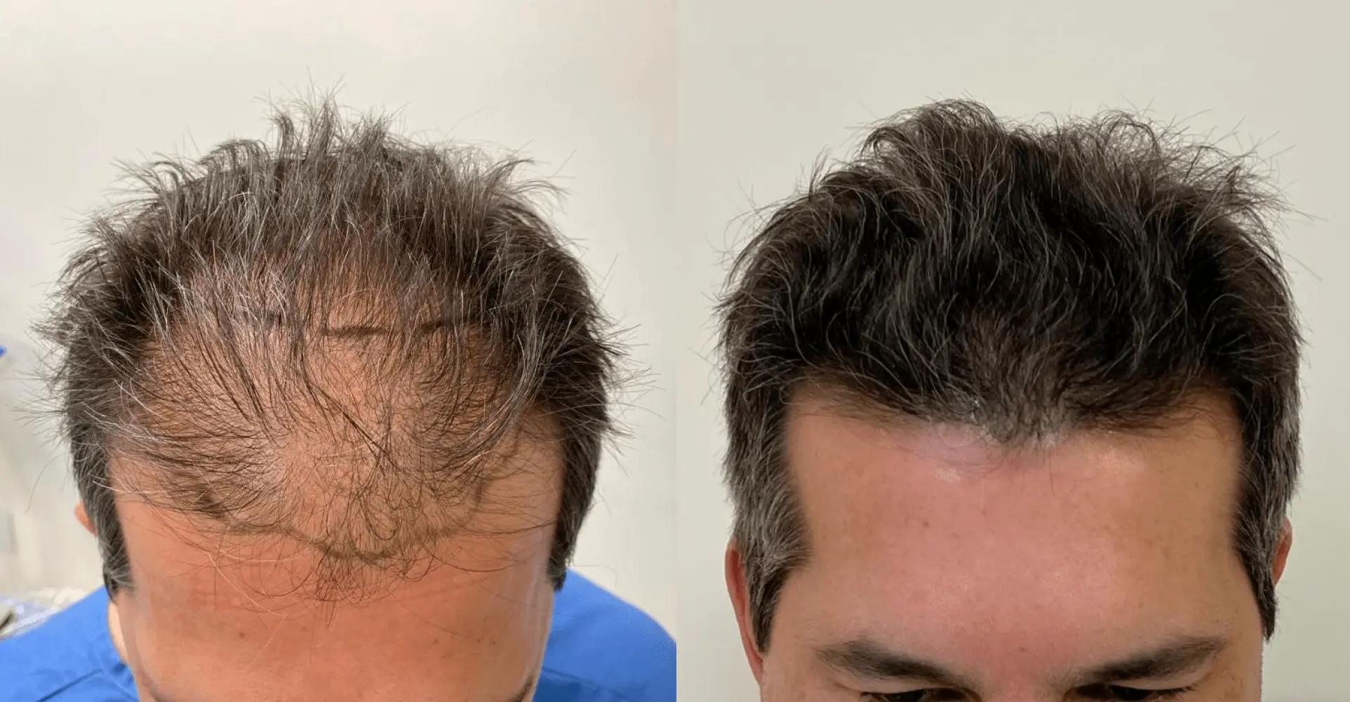 Antes e depois 2 (1)-min