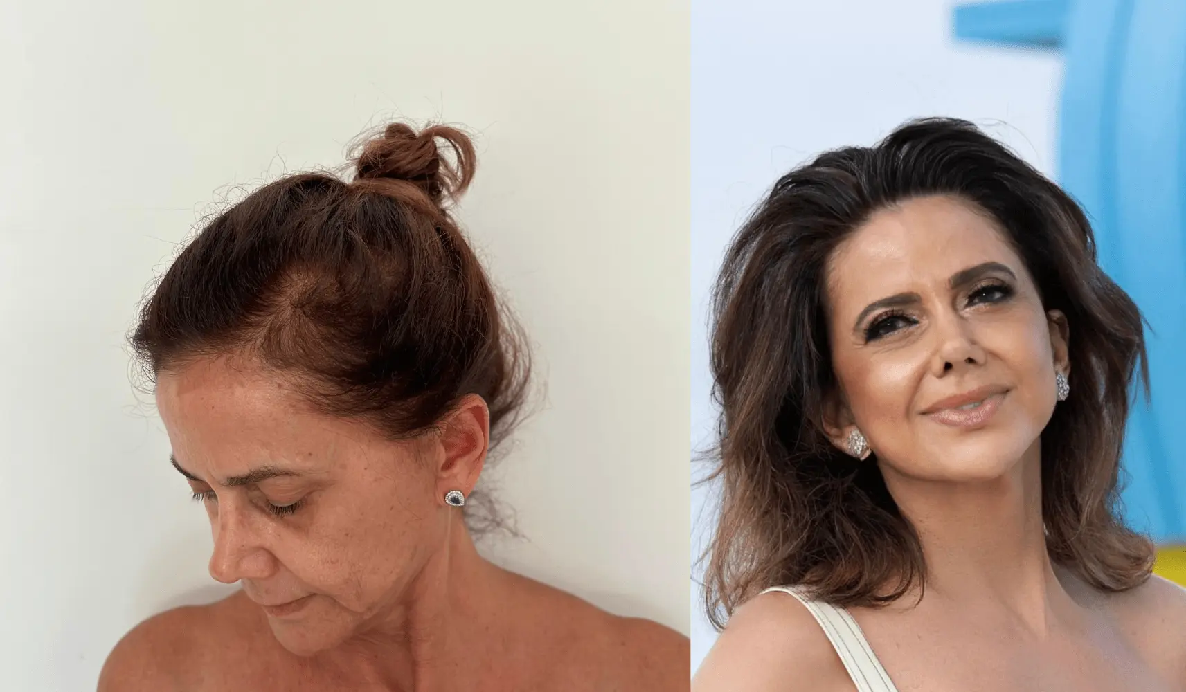 Antes e depois 4-min